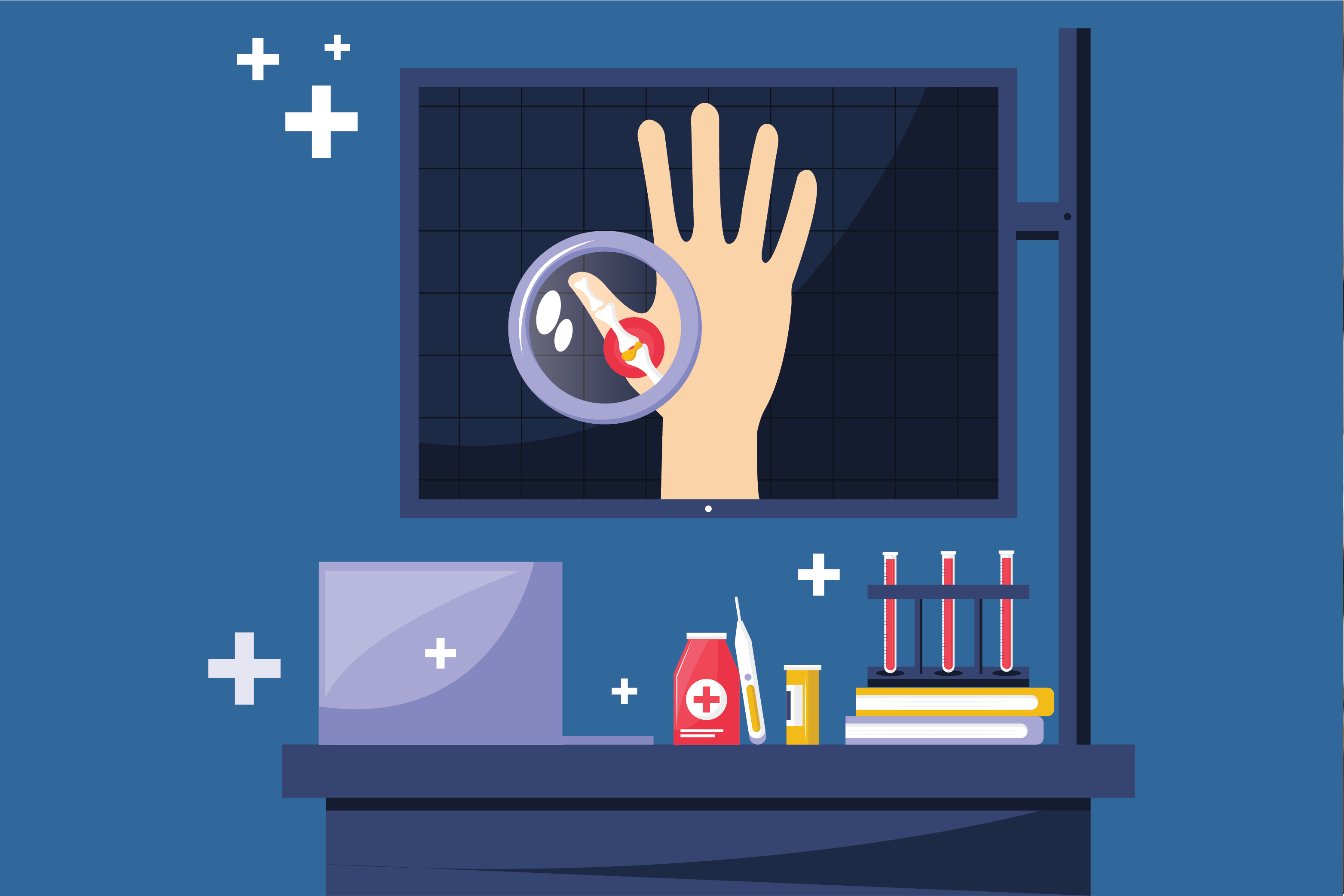 Recognizing Key Psoriatic Arthritis Symptoms