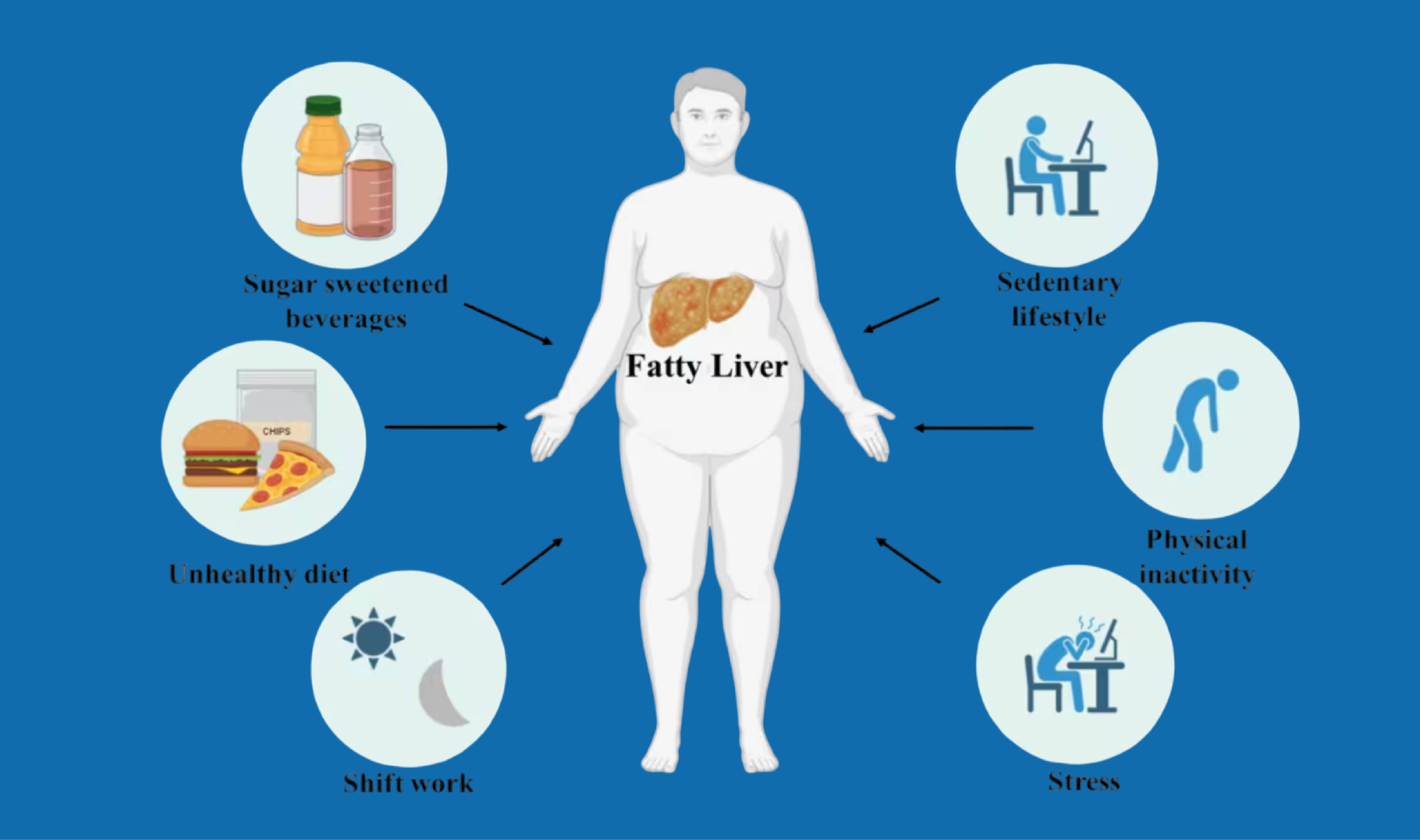 Causes of Fatty Liver Disease