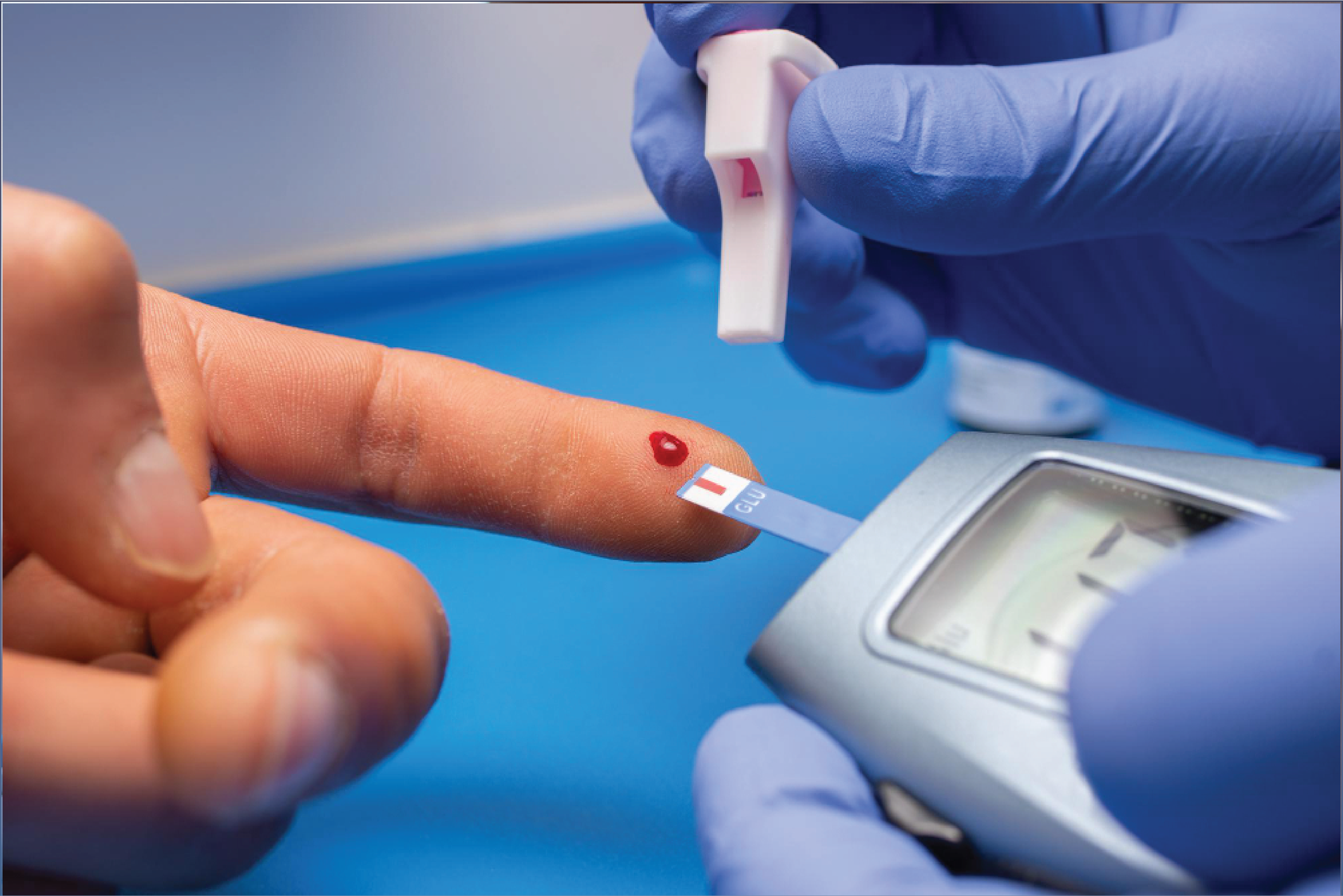 Continuous Blood Sugar Monitoring (Advanced)