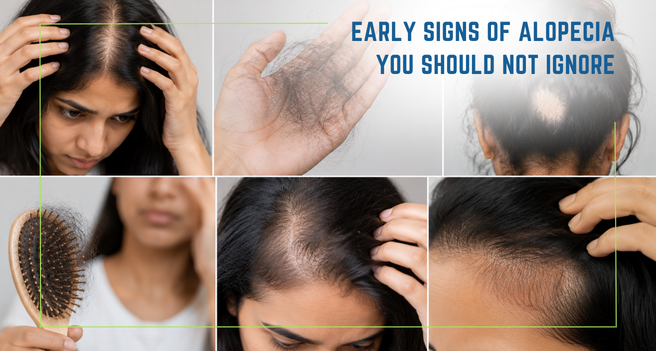 Early Signs of Alopecia You Should Not Ignore